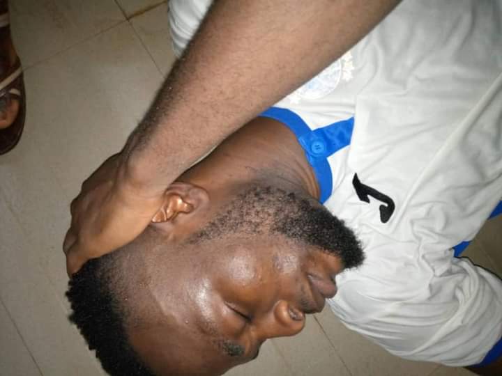 Enyimba Players Mercilessly Beaten By Plateau United Fans (Photos)