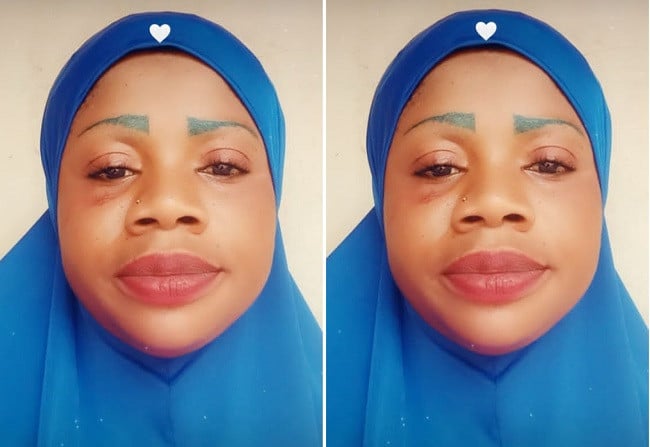 Nurse Arrested In Ogun For Injecting Man, Causing Permanent Disability To His Leg (Photo) - Vimarsana News