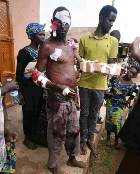Benue Man Kills Lion With His Bare Hands, Lands in Hospital - Vimarsana News