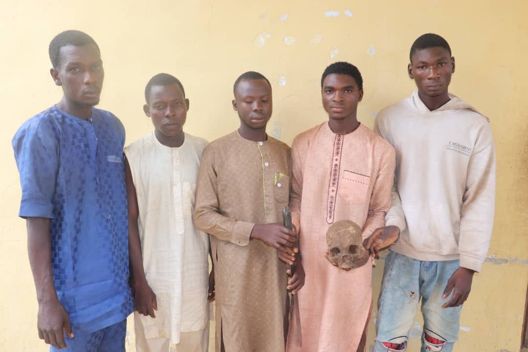 Long Sentence For 5 Money Rituals Caught With Human Skull - Vimarsana News